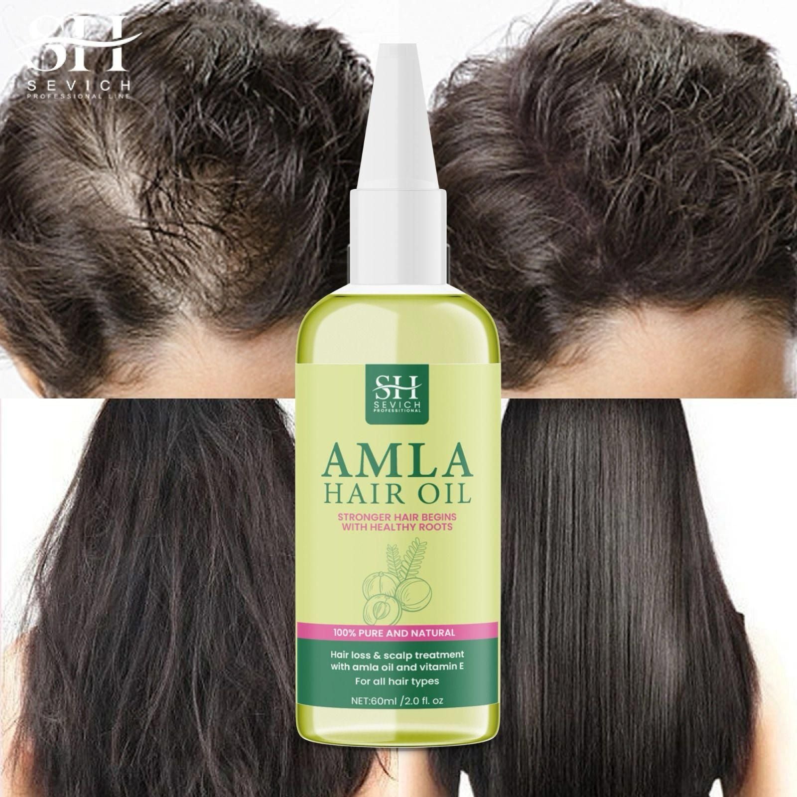 SH Amla Hair Oil 60ml - Nourish Your Hair Naturally