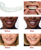 Instant and Confident on Smile Fit Flex Cosmetic Teeth Denture Teeth