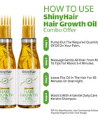 ShinyHair Growth Oil Enriched With Real Herbs 110ml (Pack of 2)